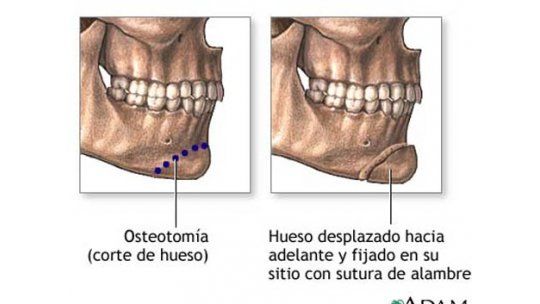 Crecen cirugías estéticas masculinas, entre ellas las de mentón