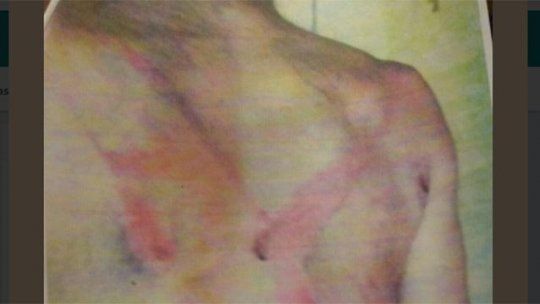 Trabajador rural reclamó reducción de horario y lo atacaron a rebencazos