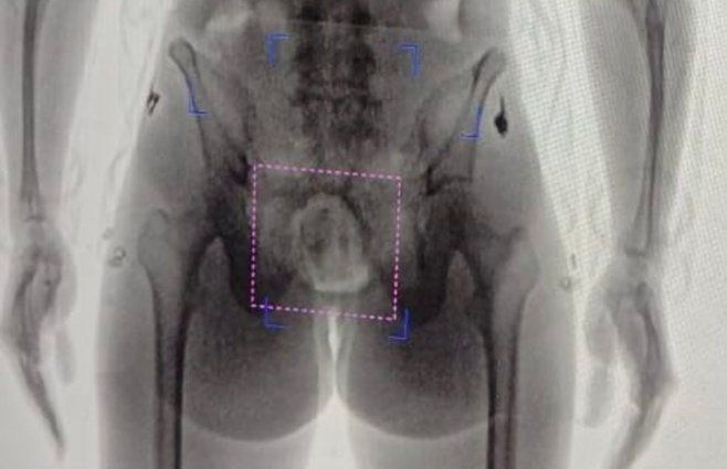 Foto: Ministerio del Interior. Resultado del escaneo realizado a la mujer, en la cárcel de Canelones.