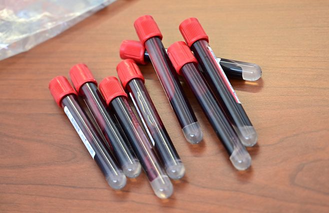 sangre-tubos-de-ensayo-coronavirus-AFP.jpg
