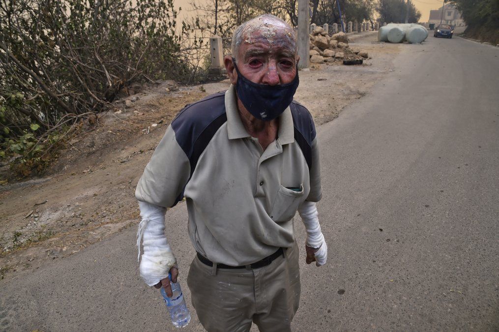 Un hombre herido camina durante un incendio forestal en Tizi Ouzou, una de las ciudades más pobladas de la región de Cabilia de Argelia.