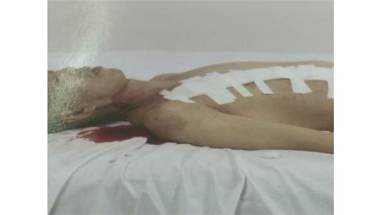 Un chino mutila y corta su cuerpo para hacer “arte”