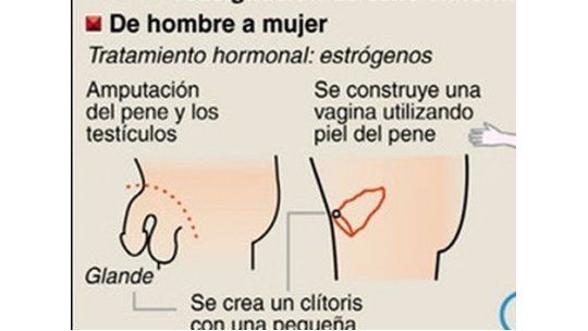 MSP ofrecerá hormonoterapia y cambio de sexo a personas trans