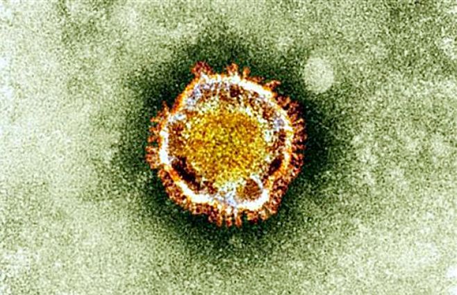 El&nbsp;coronavirus visto bajo un microscopio electrónico