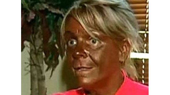 Mujer adicta a la cama solar va a juicio por broncear a su hija