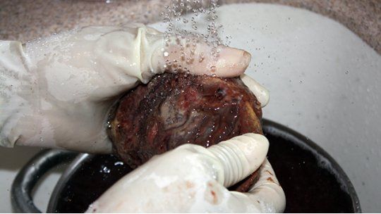 placenta