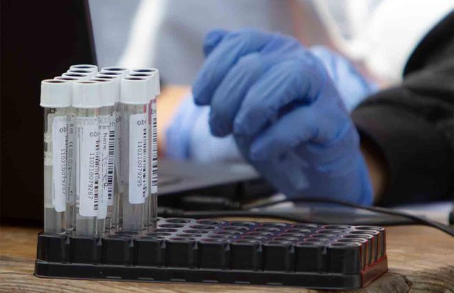 Se registraron 12 fallecidos por coronavirus y 634 casos nuevos