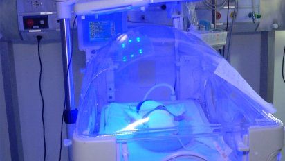 natalidad en uruguay: se reduce la prematurez, las cesareas y los embarazos adolescentes