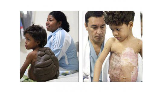 La asombrosa recuperación del niño tortuga