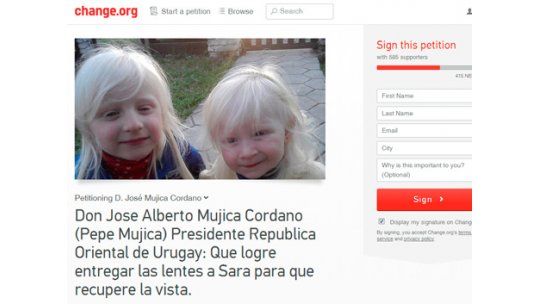 Tras la polémica, las niñas albinas tienen sus lentes