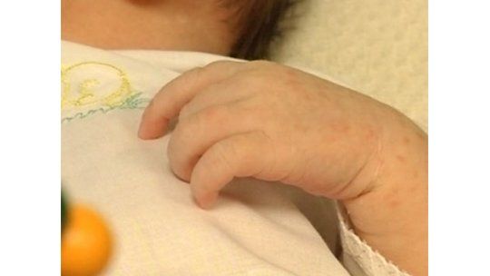 Falleció la niña que inspiró la ley argentina de muerte digna