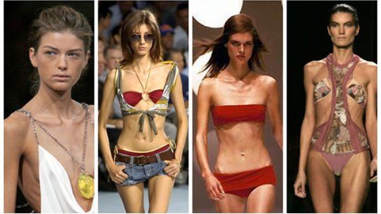 modelos anorexia