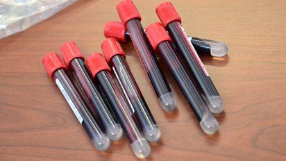 Coronavirus en Uruguay: 651 casos nuevos, 10 fallecidos y 95 pacientes en CTI