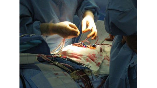 Justicia anuló decisión de FNR que estableció monopolio de stents