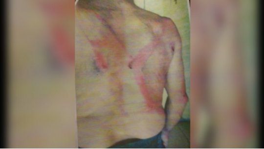 peón rural agredido