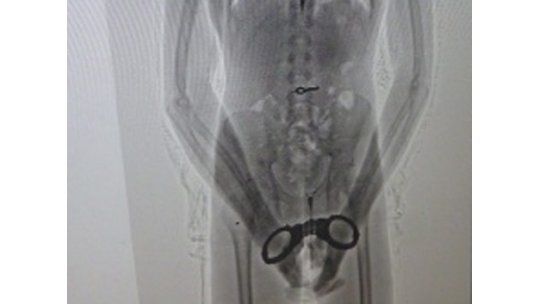 Insólito: preso se tragó llave de esposas y el escáner lo detectó