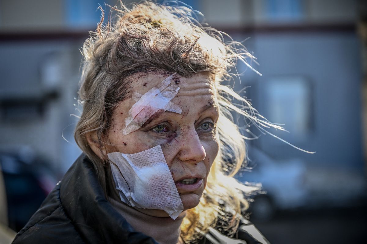 Una mujer herida seencuentra frente a un hospital después del bombardeo de la ciudad deChuguiv, en el este de Ucrania.
