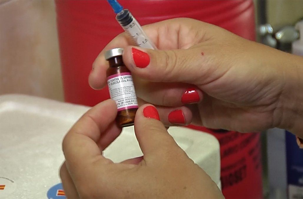 Casos leves de paperas se registraron en personas vacunadas contra el sarampión