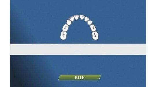 La mordida en las redes sociales y los medios de todo el mundo