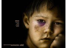 Tres niños con desnutrición y golpes; padres fueron procesados