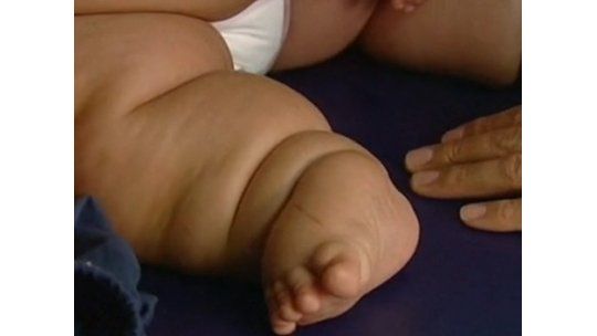 El bebé más gordo de Colombia tiene 8 meses y pesa 20 kilos