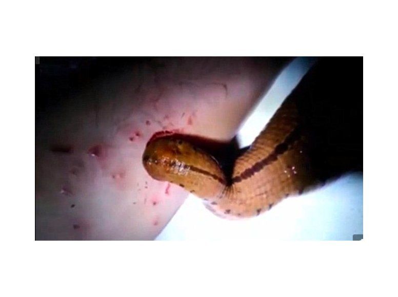 Hombre tiene sanguijuela como mascota y la alimenta con su propia sangre