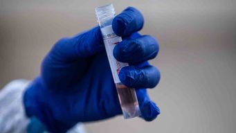 datos covid-19: 168 casos nuevos, 3 fallecidos y 15 en cti