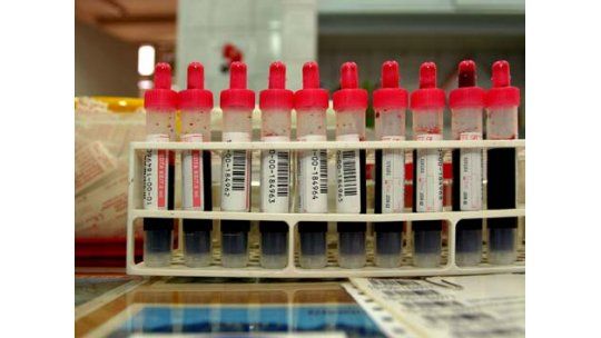 Análisis de sangre permitiría saber cuándo vamos a morir