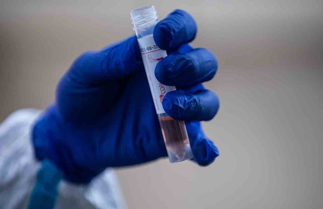 Se registraron 831 casos nuevos de Coronavirus y ocho fallecidos