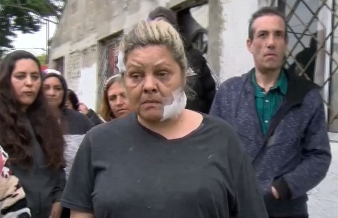 mujer-ataque-perro-villa-crespo.jpg