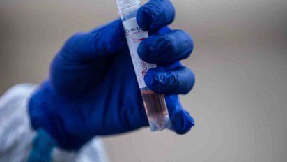 Bajo a 5.858 la cantidad de activos de Coronavirus; hubo 504 casos nuevos