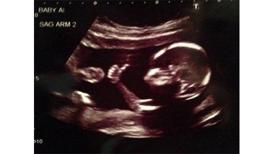 Increíble el bebé que saluda a sus padres en las ecografías