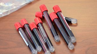 se registraron 260 casos nuevos y hay 1.993 personas cursando la enfermedad