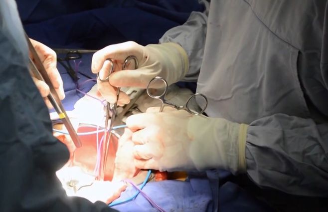 operación-órganos-salud