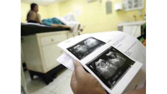 Abortos: se realizan 13 por día a 6 meses de vigencia de la ley