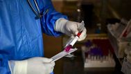 Suben a 2.350 los casos activos de Covid-19 y hay 25 pacientes en CTI