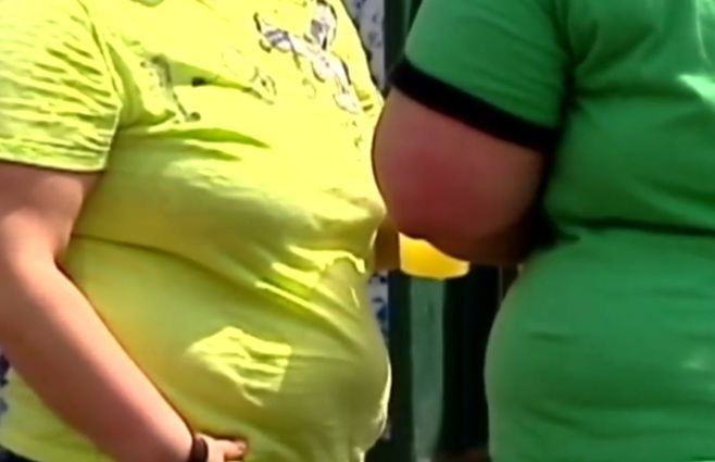 OBESIDAD-EN-EL-MUNDO--OMS--INFORME.jpg
