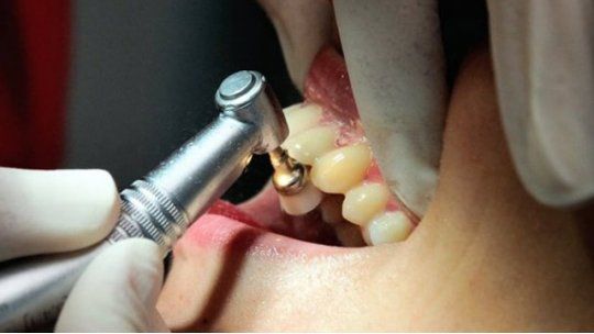 odontología dientes
