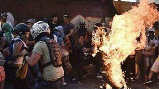 venezuela quemado