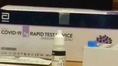 policlinicas haran test de covid con diagnostico en 15 minutos
