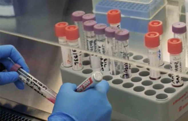 analisis-covid-detección-frascos-pcr.jpg