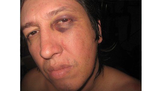 Denuncian maltratos, golpes y robo de policías en un allanamiento